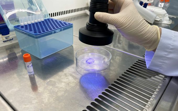 Miếng vá sinh học tồn tại ở dạng gel và phải chiếu ánh sáng UV để nó đông cứng và liên kết vào thành tim. Ảnh: Hà An